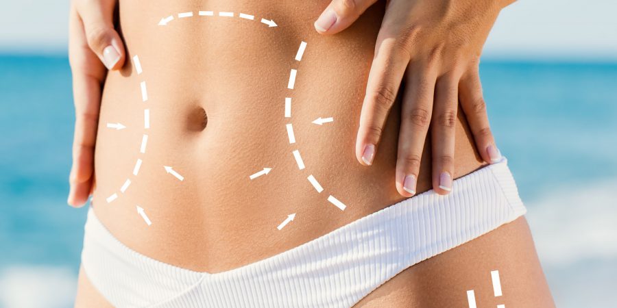 Tummy Tuck & Body Contouring: Ο συνδυασμός που κάνει τη διαφορά!
